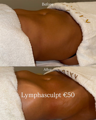 Lymphasculpt